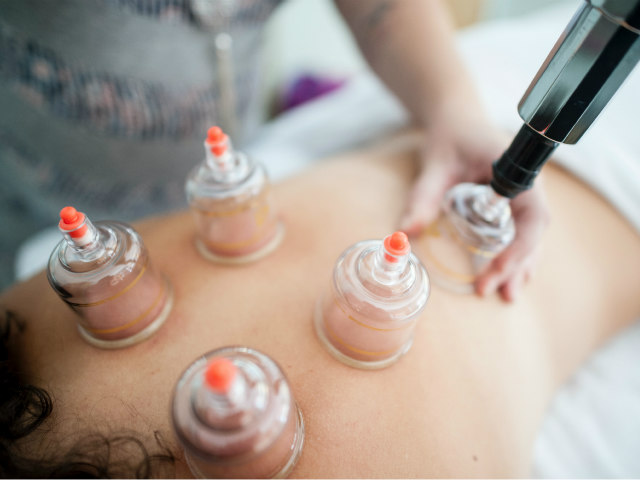 A person is getting an acupuncture treatment.